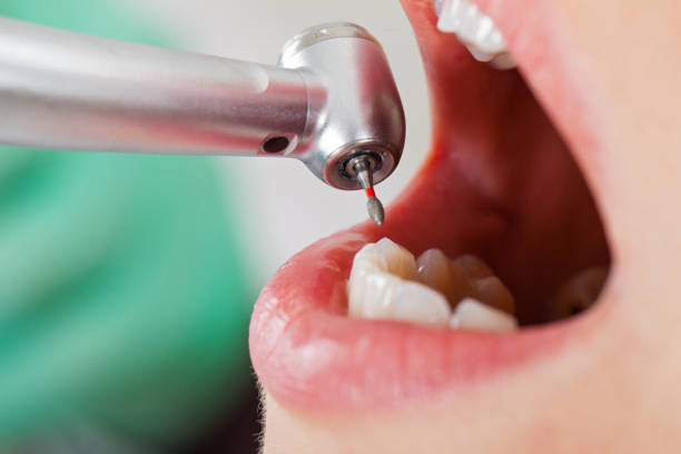 Best Cosmetic Emergency Dentistry in Buckley, WA